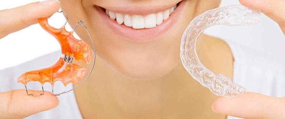 woman holding retainer for teeth dental braces and individual tooth tray